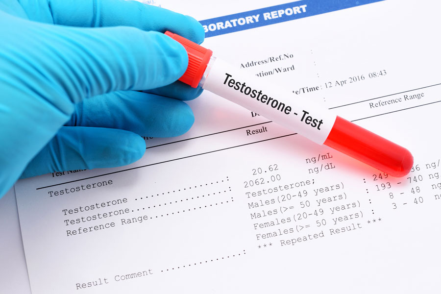 Testosterone test with test tube and results